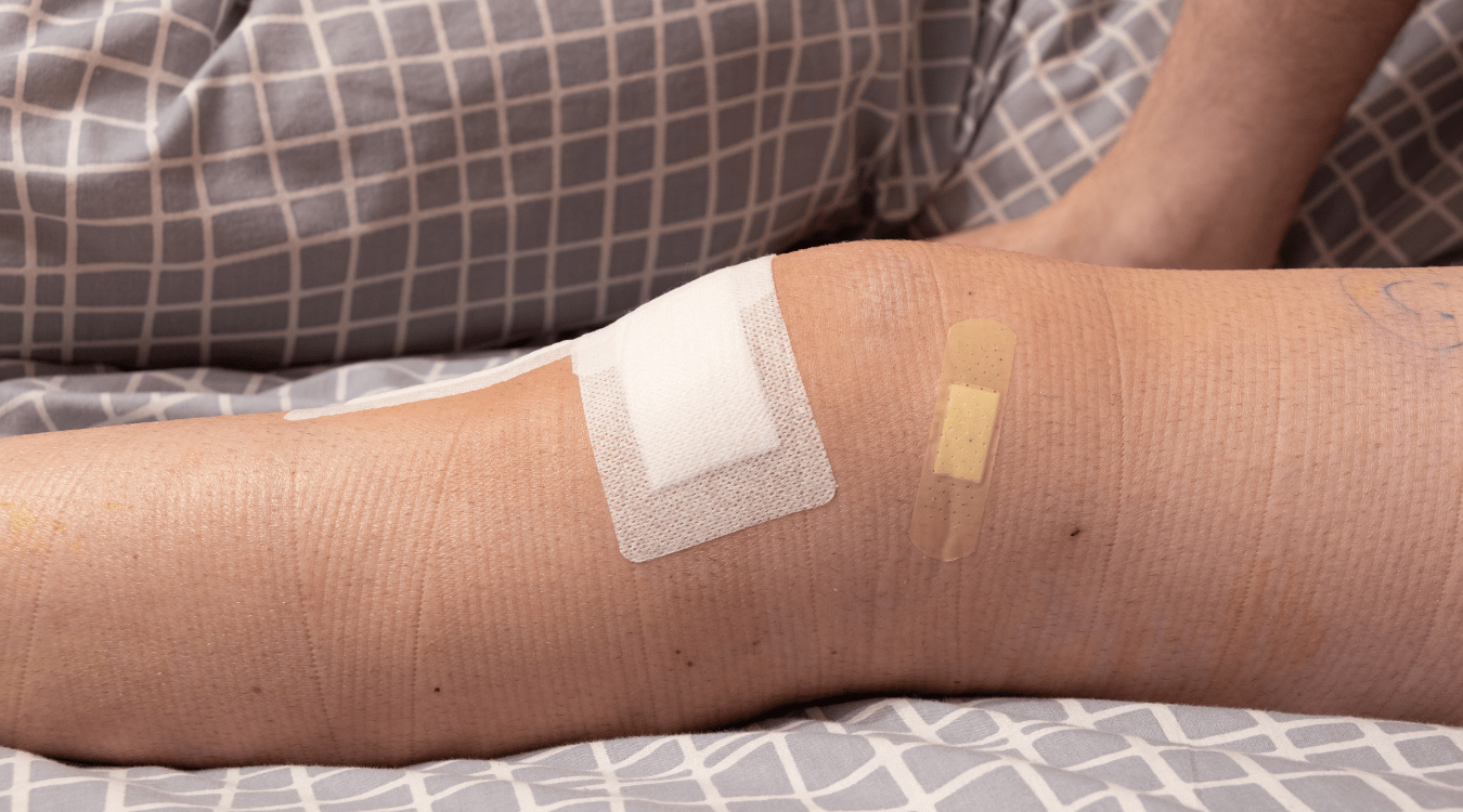 How long should you sleep with your leg elevated after knee surgery